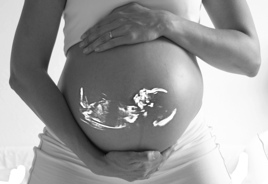 Kıbrıs Tüp Bebek Merkezi Hamile Kadın
